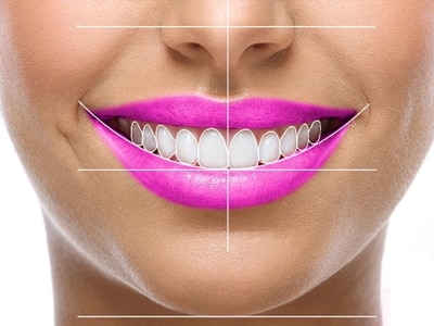 Diseño Sonrisa